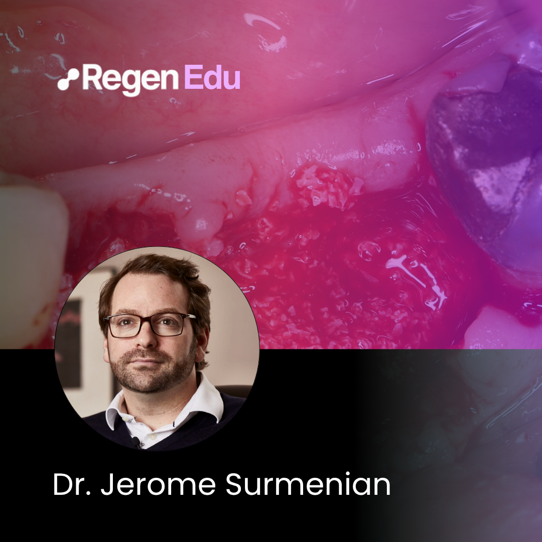 Bone augmentation performed simultaneously with dental implant placement